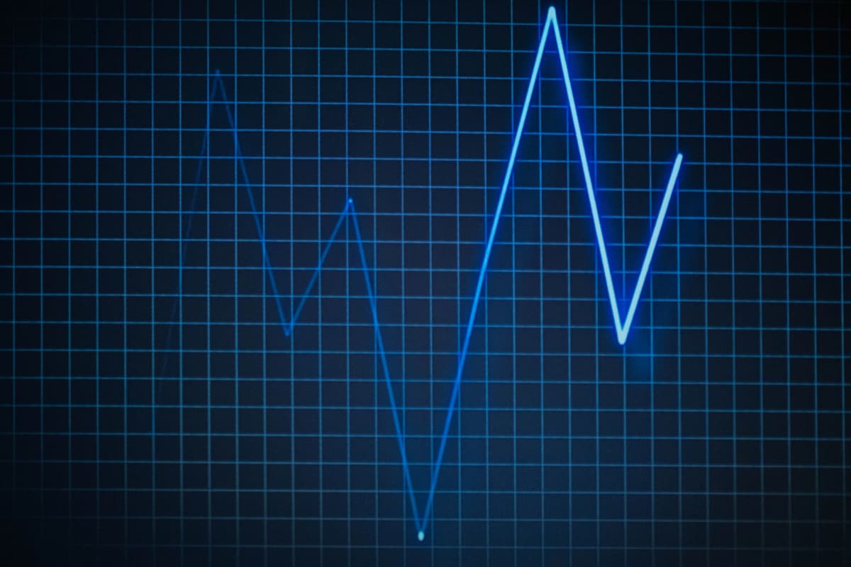 Sleep pattern chart showing sleep stages over time